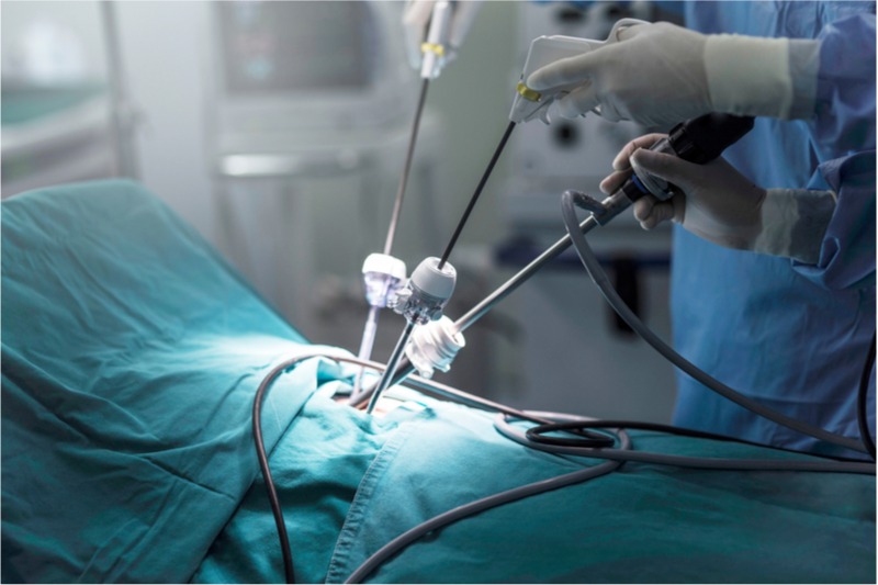 Risk-Reducing Gynecological Surgery